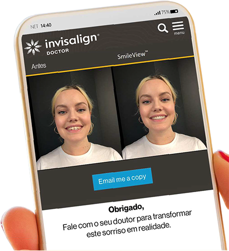 Invisalign