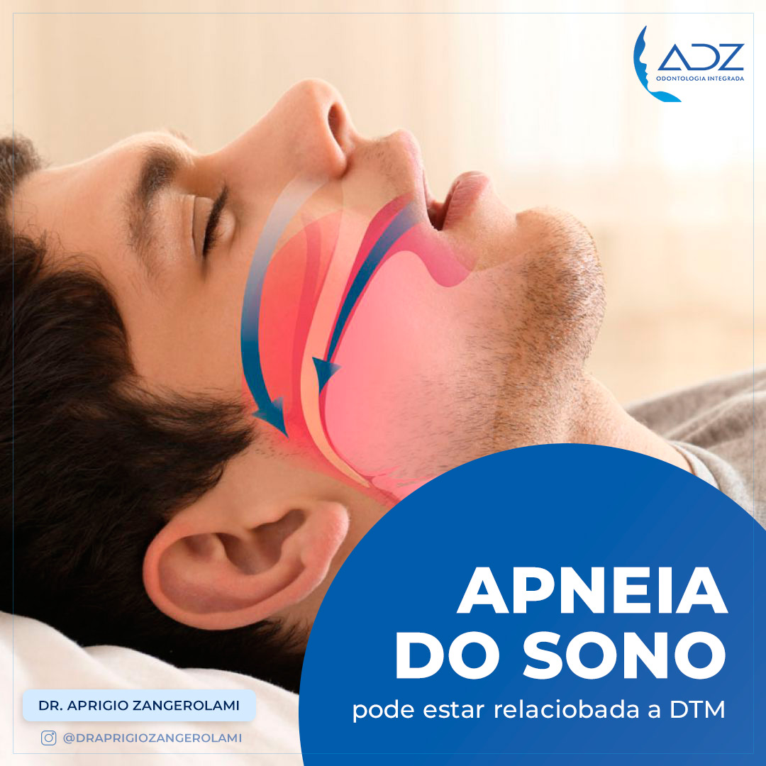 Apneia Obstrutiva do Sono