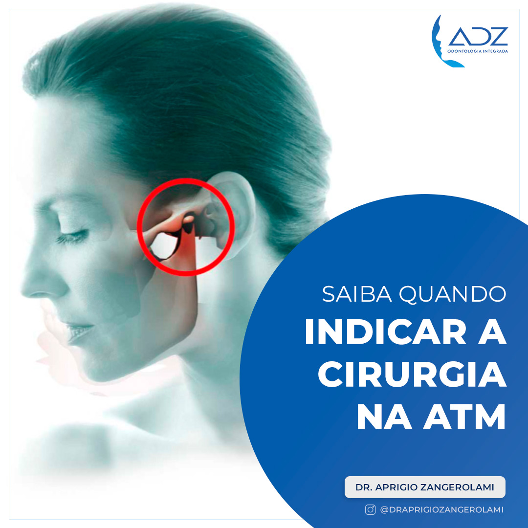 Saiba quando indicar a cirurgia na ATM para o paciente