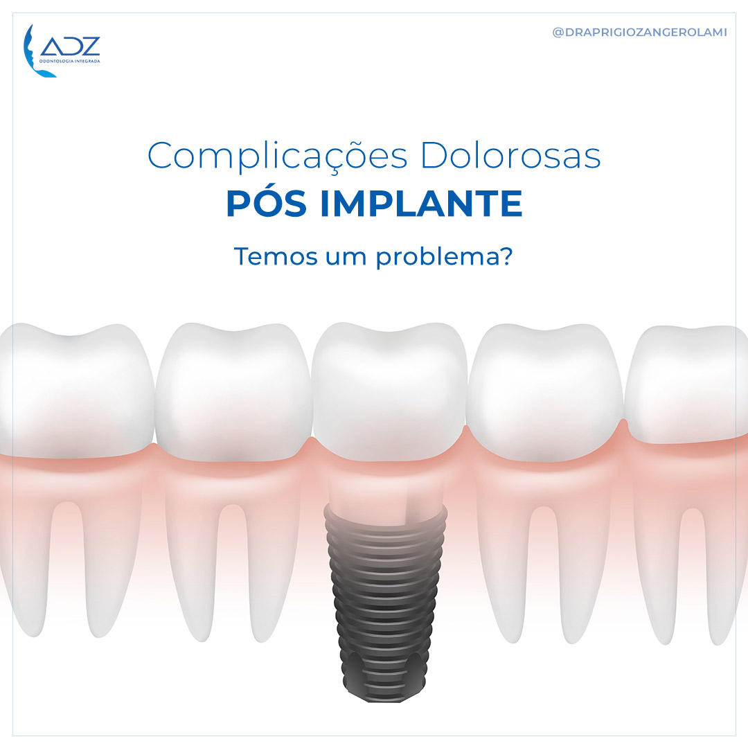 Complicações Dolorosas Pós Implante