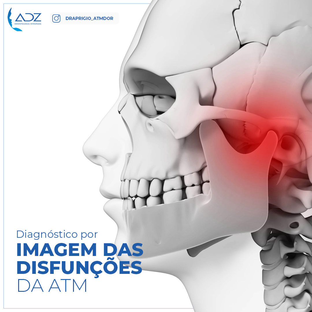 Diagnóstico por imagem das disfunções da ATM