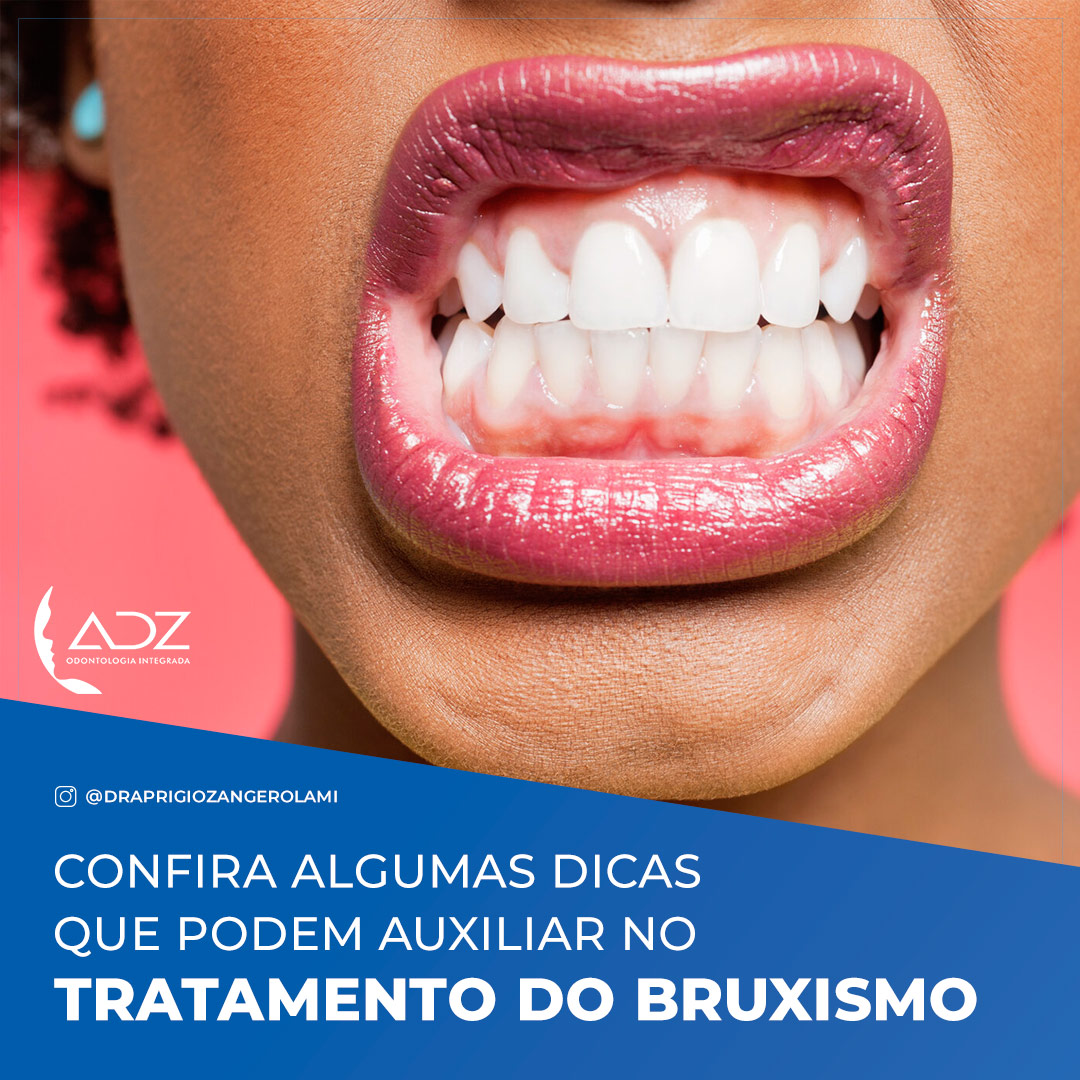 Dicas para tratamento do bruxismo