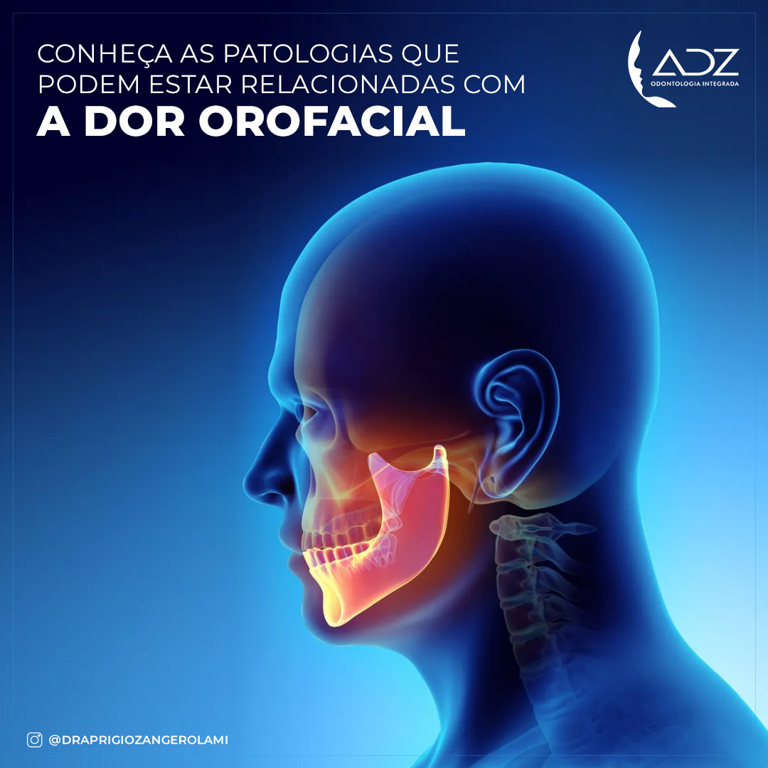 Dor Orofacial