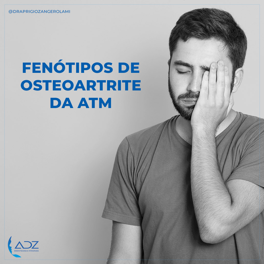 Fenótipos de Osteoartrite da ATM