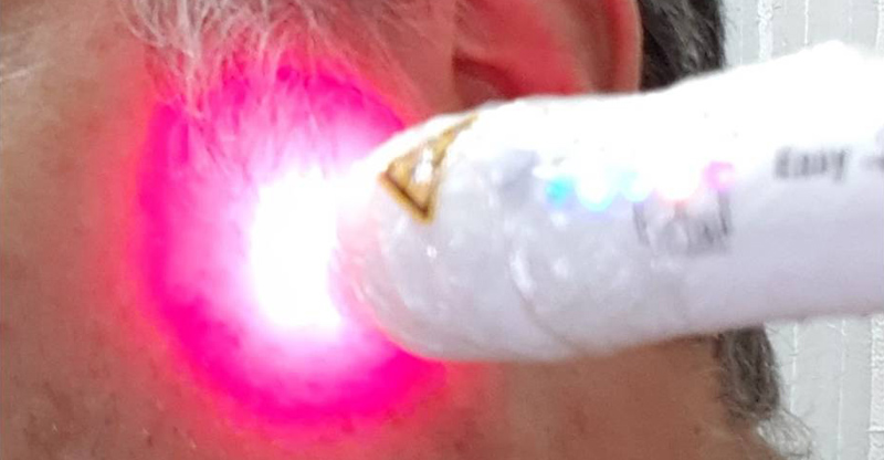 Fisioterapia com Laser